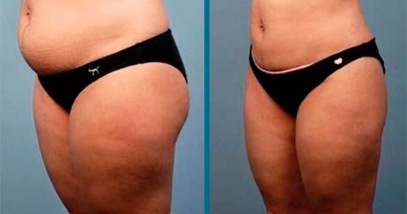 kaedah untuk menurunkan berat badan sebanyak 10 kilogram dalam sebulan